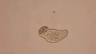 metacercaria