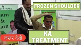 Frozen Shoulder Treatment | Frozen Shoulder Exercises at Home | जमे हुए कंधे का उपचार | ArogyaPeeth