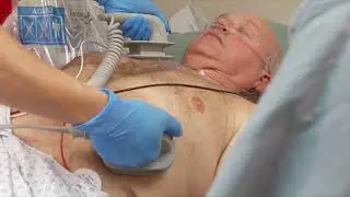 Manual Defibrillation with the HeartStart XL+ monitor/defibrillator