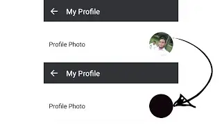 Botim DP हटाएं | How to Remove DP of Botim Account | Remove Profile Pic in Botim | | Tech Cutting
