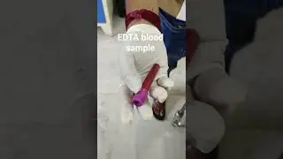 #EDTA #tubes  #tube #sample #blood #hospital #ytshorts #collection