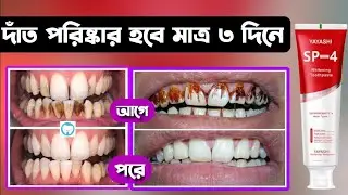 yayashi sp 4 toothpaste Review | দাঁত সাদা করার সেরা টুথপেস্ট
