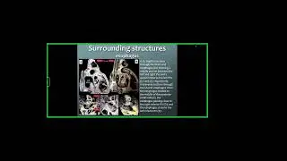 Cardiac anatomy for the electrophysiologist   Dr  John Kamel