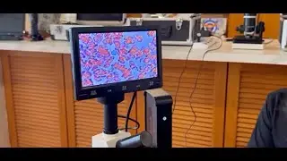 Daily usage of Gadgets & Blood Cells Explained | Changes With Devices and with using Enagic emGuarde