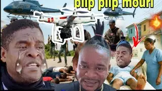 Lanmo100jou ka mouri konplo..babekyou menm trè mal...viv ansanm kraze, drone anpil dega...