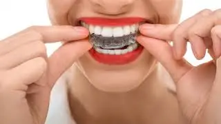 Is Invisalign Really Better than Braces in Lighthouse Point | Sedation Dental Spa