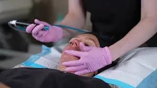 HydraFacial