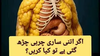 Treatment of Obesity Through Lifestyle Modifications/ DR Tanveer Arshad Ch 