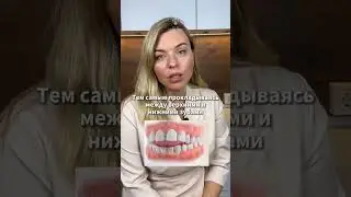 Что у нее с зубами? Узнай какой прикус у тебя - по ссылке в шапке канала