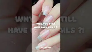 POV : You tried all Nail Growth tips BUT nothing work 🥲 ||