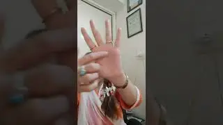 Navel Displacement Treatment | Acupressure Points For Navel Disorder