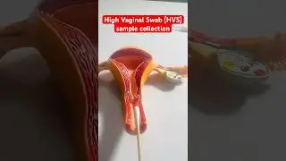 High Vaginal Swab