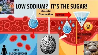 Sodium and Glucose: The Osmotic Connection