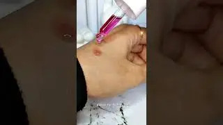Implora Peeling Serum✨️ #cute #skincare #implora #fyp #beauty