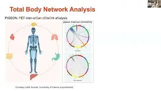 Australian Total Body PET: Webinar one | Technology and clinical research with Prof Steve Meikle