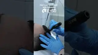 Лечение волос экзосомами и РЕЗУЛЬТАТЫ