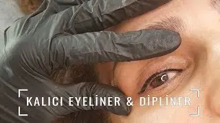 Kalıcı dipliner nedir, nasıl uygulanır?