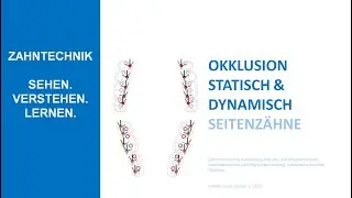 Statische und dynamische Seitenzahnokklusion - Basics