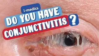 Do You Have an Eye Infection?👨&zwj;⚕️🩺