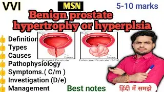 BPH | Benign prostate hypertrophy or hyperplasia in Hindi  | pathophysiology, defi, causes, symptoms