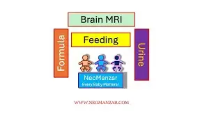 Brain MRI, Feeding volume, Formula change