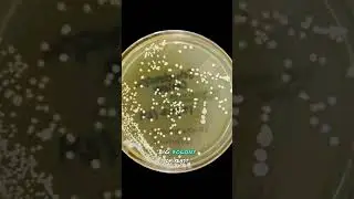 Sourdough starter under a microscope. #sourdough #sourdoughstarter #sourdoughbread