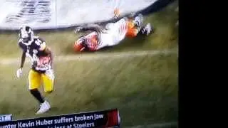 Bengals punter Kevin Huber broken jaw cracked  vertebrae
