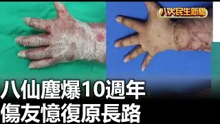 八仙塵爆10週年 傷友憶復原長路 |【民生八方事】| 2026012708 #八大民生新聞