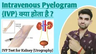 Intravenous Pyelogram in Hindi || Intravenous Pyelogram Procedure || IVP Test for Kidney