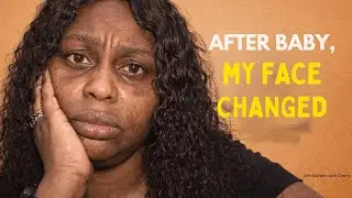 Postpartum Skin Problems Nigerian Doctors Don&rsquo;t Explain (Dryness, Dark Patches & Breakouts)