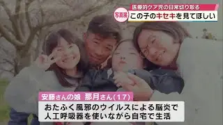 「同じ子供なんだよ、家族なんだよ」　医療的ケア必要な子供たちの日常切り取った写真展　大分