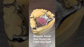 Obturator Partial designed precisely! #dentist #dentallab #dentalartistry #teeth #oralsurgery