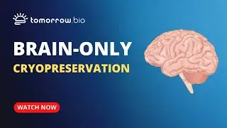 Tomorrow Bio Offering Brain-Only Cryopreservation