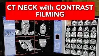 NECK CT scan Filming Protocol.
