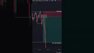 #theduettraders #daytrading #real #realtrade #stockmarket #tjr #sad #realtrader #stocktrading #memes