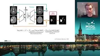 MIDL 2021, G8, Heer et. al., Full Paper