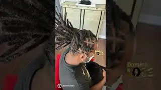 Locs Transformation! | Alopecia and Dreadlocks