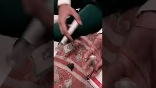 Como dividir a dose &uacute;nica do Mounjaro de 5mg para 2,5 mg.