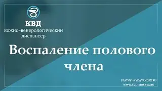 699 Воспаление полового члена