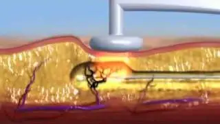 Manhattan Plastic Surgery, Body Contouring NYC
