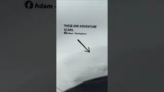 These are #Adventure #Scars. #greenlanes #adventureexploring #daciaduster4x4