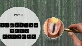 Decoding Nail signals