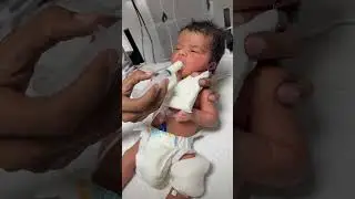 Newborn baby syringe fedding baby is stable admit in nicu#cutebaby#baby