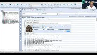 Master Homeopathy with RadarOpus! | Search a Single Rubric + Tinea Pedis (Athlete's Foot) Case
