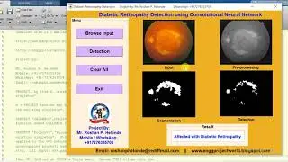 Diabetic Retinopathy Detection using Convolutional Neural Network full Matlab Project