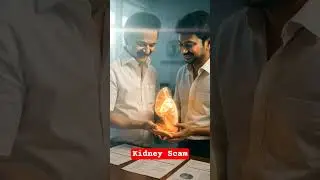 Kidney Scam..#dmk #funny #aiadmkitwing #indianpolitics #admk