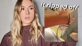 Did I Keep My Hand When It Ripped Off? // Amputee Q&A