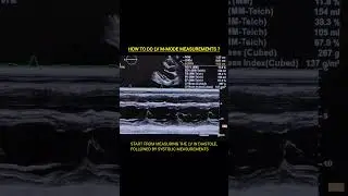 LV M-mode Measurements #echocardiography #echo #cardiology #ultrasound #cardiachealth #hearthealth