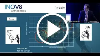 Functional Anteversion (Dr. Stefan Kreuzer)