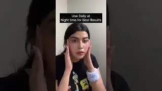 Real User   Real Results ✔️😍The magical Proskire Niacinamide serumAvailable on Flipkart, Amazon